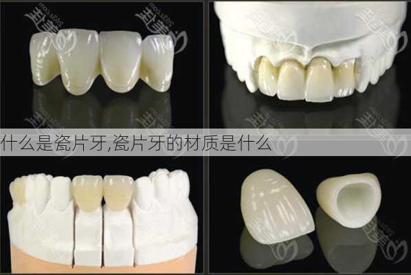 什么是瓷片牙,瓷片牙的材质是什么